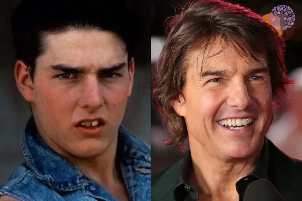The Early Days Tom Cruise Teeth Before Fame